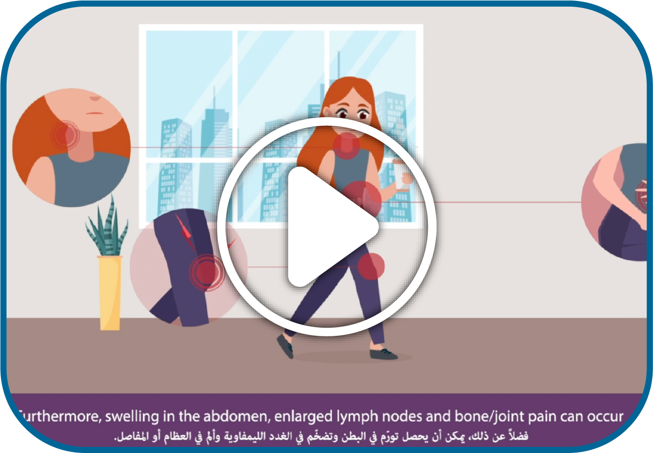 Explainer Video Preview